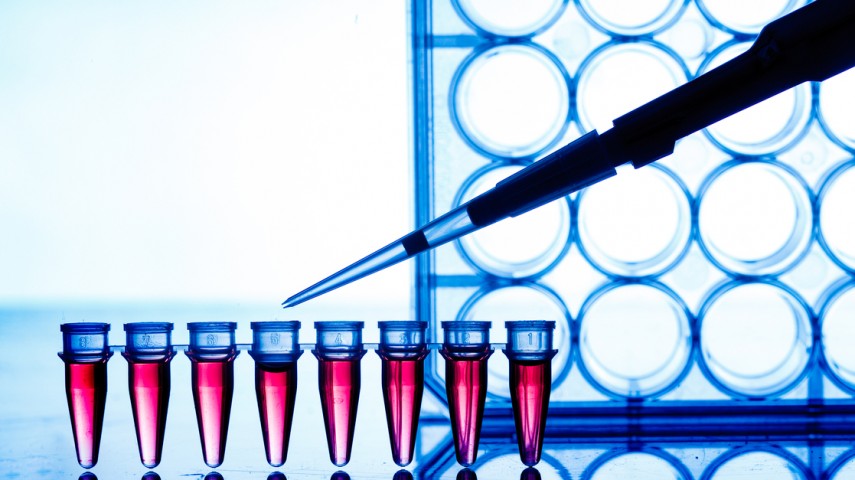 Perform PCR test for COVID-19 infection!