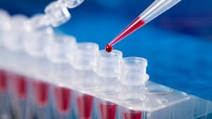 COMBO PCR test za  SARS/CoV2/Influenzu A i B